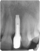 X-ray