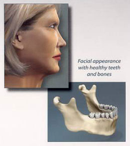 Healthy Teeth and Bone