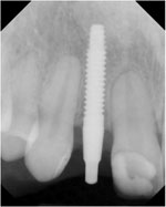 X-ray right