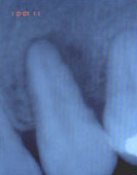 final_rest14 X-ray
