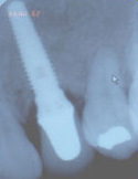 final_rest16 X-ray