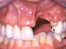 final_rest7 Final Post-Operative Results