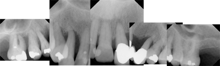 Pre-Op X-rays