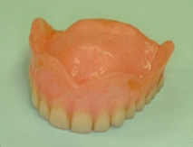 Temporary Denture